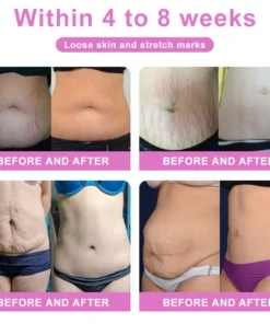 KaaLa™ Ceramic Ice Ionic Fiber Repair Shaping Pants