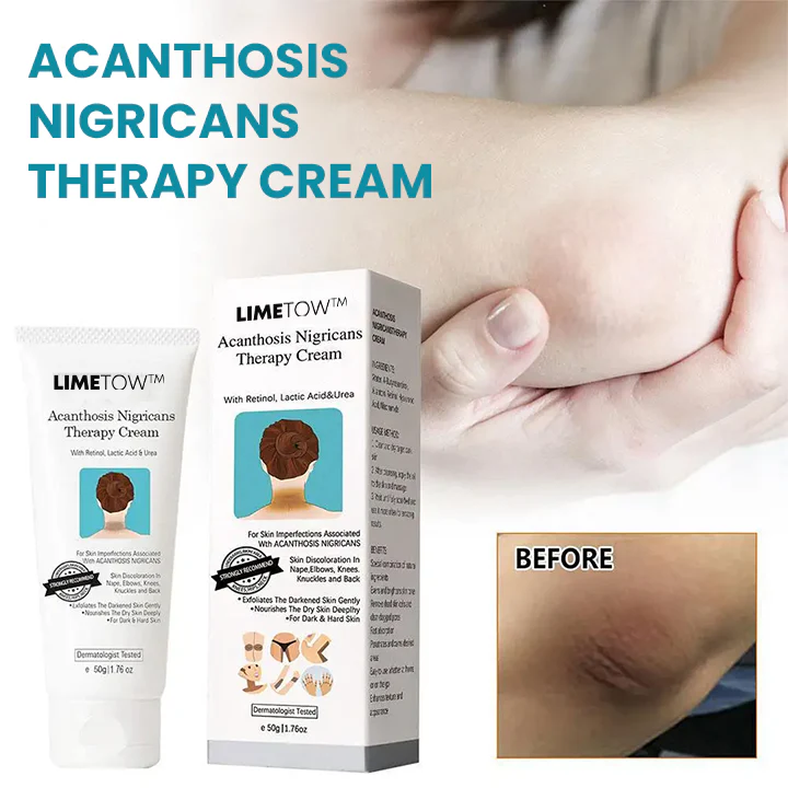 LIMETOW™ Acanthosis Nigricans -hoitovoide