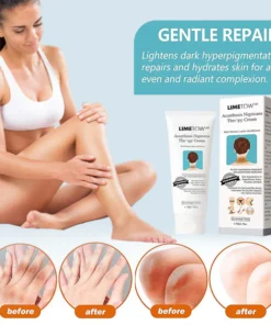 Alternative view of LIMETOW™ Acanthosis Nigricans Therapy Cream