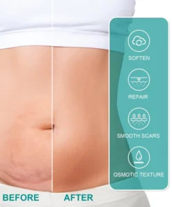 LIMETOW™ Advanced Scar Spray