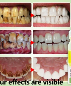 LIMETOW™ FreshPlus Bee Venom Ampoule Toothpaste