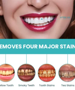 LIMETOW™ Instant Teeth Whitening Paint