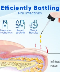 LIMETOW™ OnyxoGuard Nail Growth and Repair Serum