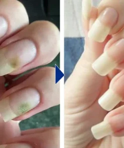 LIMETOW™ OnyxoGuard Nail Growth and Repair Serum