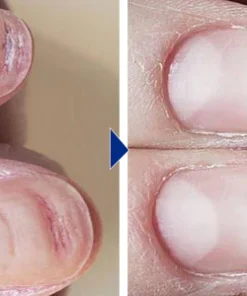 LIMETOW™ OnyxoGuard Nail Growth and Repair Serum