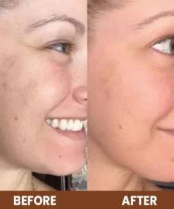 LIMETOW™ Propolis Essence Anti-Wrinkle Moisturizing Stick