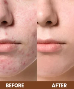 LIMETOW™ Propolis Essence Anti-Wrinkle Moisturizing Stick