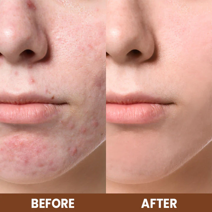 LIMETOW™ Propolis Essence Anti-Wrinkle Moisturizing Stick