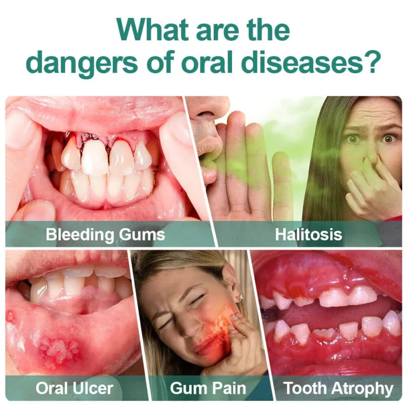 LIMETOW™ Ultra Healing Herbal Mouth Spray