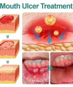 LIMETOW™ Ultra Healing Herbal Mouth Spray