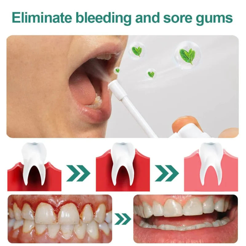 LIMETOW™ Ultra Healing Herbal Mouth Spray