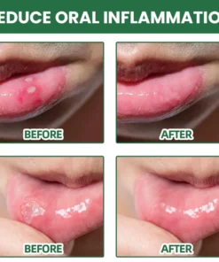 LIMETOW™ Ultra Healing Herbal Mouth Spray