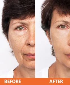 LIMETOW™ Vitamin C Anti-Aging Serum