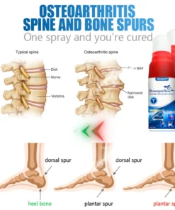 LIMETOW™Shark Collagen Spray: The Ultimate Solution for Bone Spur Relief and Joint Mobility