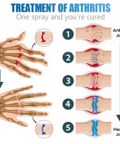 LIMETOW™Shark Collagen Spray: The Ultimate Solution for Bone Spur Relief and Joint Mobility