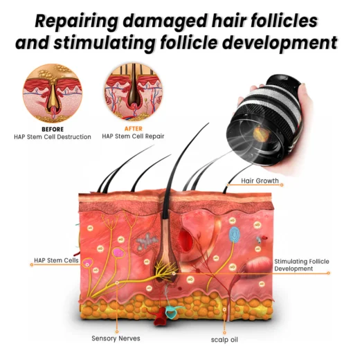 LUHAKA™ Moxibustion Hair Regrowth Device