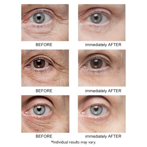 LUMINEYE™ Pure Pearl Begi Gela
