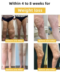 Lukmlca™ 𝐁𝐞𝐞 𝐕𝐞𝐧𝐨𝐦 𝐋𝐲𝐦𝐩𝐡𝐚𝐭𝐢𝐜 𝐃𝐫𝐚𝐢𝐧𝐚𝐠𝐞 & 𝐒𝐥𝐢𝐦𝐦𝐢𝐧𝐠 𝐅𝐨𝐨𝐭 𝐒𝐨𝐚𝐤 𝐁𝐞𝐚𝐝𝐬