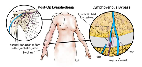 Lymphatic Detox inkiväärikylpykuorintasuolat