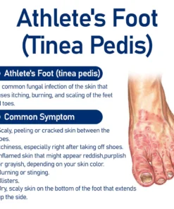 Medical nail fungus foot spray