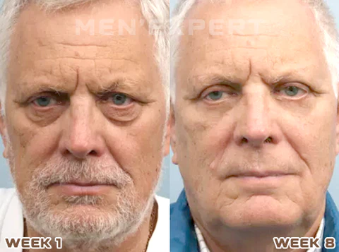 Men'Expert Pro Hydra Energetic Eye Roller