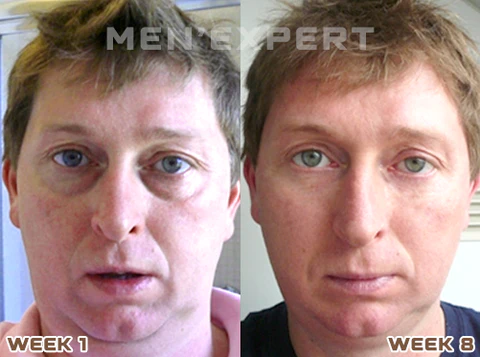 Men'Expert Pro Hydra Energetic Eye Roller