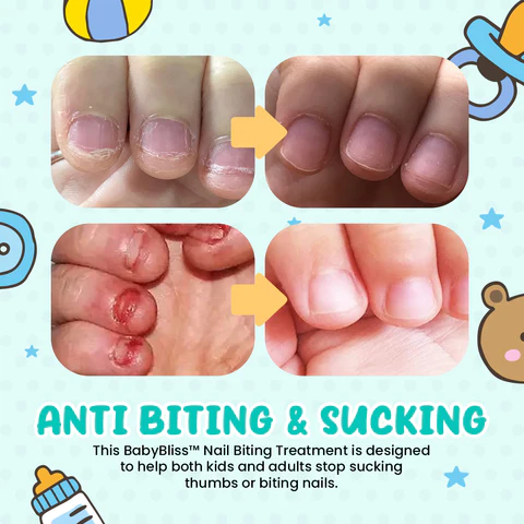 Nail Biting Treatment 