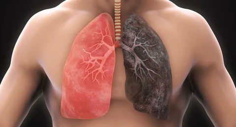 Organic Herbal Lung Cleanse Repair Patch