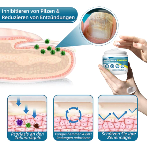 Ourlyard™ Multi-Symptom Psoriasis-Behandlungscreme