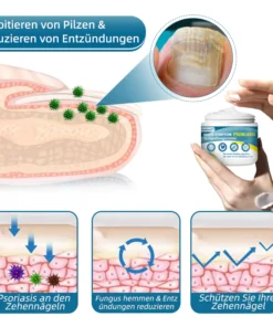 Ourlyard™ Multi-Symptom Psoriasis-Behandlungscreme