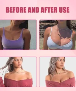 قناع تصحيح تعزيز الثدي من Oveallgo™ BustBloom