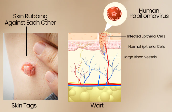 Oveallgo™ RespiRelief Rotlicht Nasaltherapiegerät