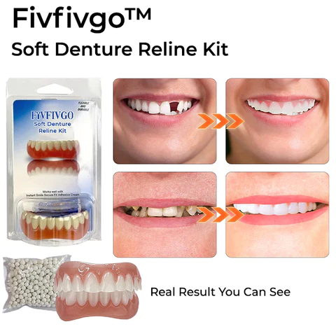 Oveallgo™ pehmeä hammasproteesi Reline Kit