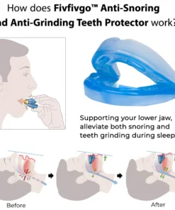 Oveallgo™ Anti-Snoring and Anti-Grinding Teeth Protector