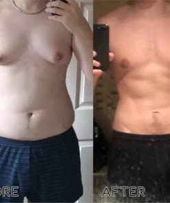 Oveallgo™ Bee Venom Heat Sculpt Anti-Swelling Cream