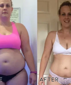 Oveallgo™ Bee Venom Heat Sculpt Anti-Swelling Cream