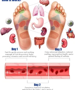 Oveallgo™ Foot Massage Socks and Acupuncture Tool Set