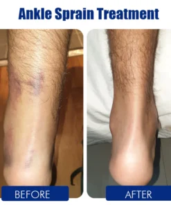 Oveallgo™ Foot Massage Socks and Acupuncture Tool Set