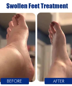 Oveallgo™ Foot Massage Socks and Acupuncture Tool Set