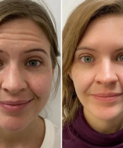 Oveallgo™ Ginseng Anti-Aging Roller