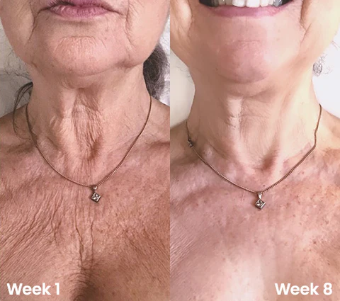 Oveallgo™ GlowBod Skin Firming Lotion