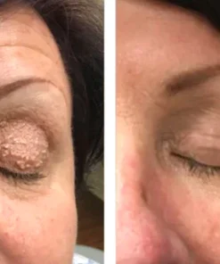 Oveallgo™ LuminEyez Collagen Anti-Wrinkle Eye Cream