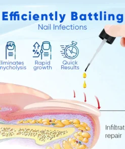 Oveallgo™ OnyxoGuard Nail Growth and Repair Serum