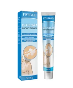 Oveallgo™ Vitiligo Vanish Cream