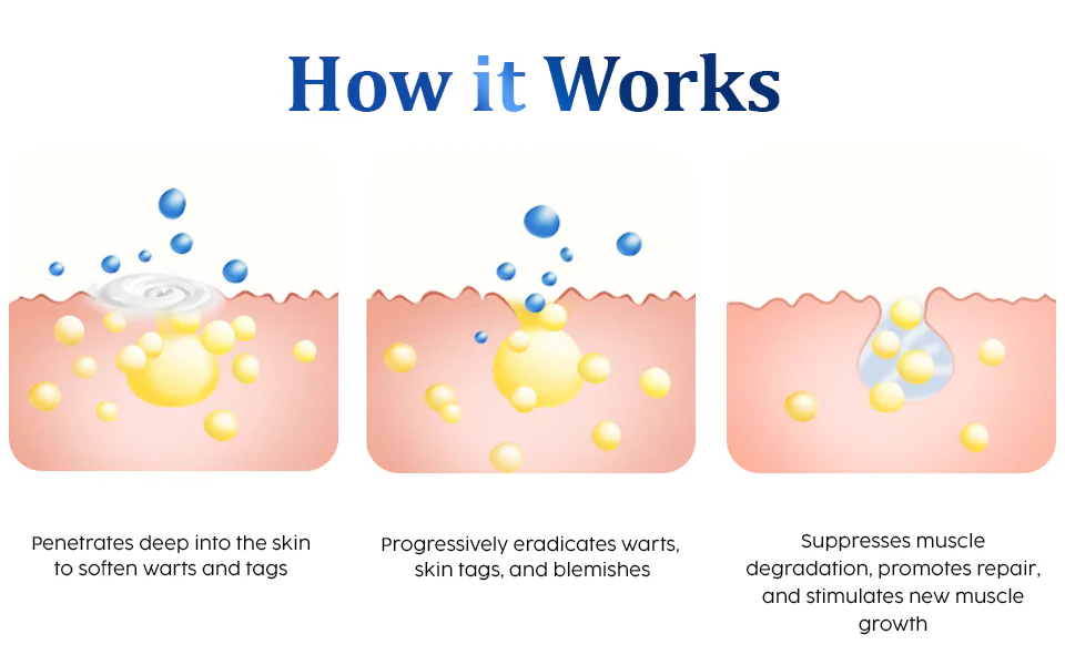 Oveallgo™ WartsOff Ultimate Blemish Removal Cream - PREMIUM