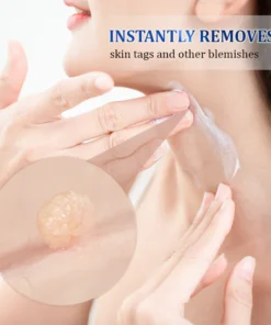 Oveallgo™ WartsOff Instant Blemish Removal Cream - PREMIUM