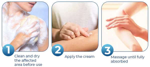SEURICO™ Vitiligo Therapy Cream