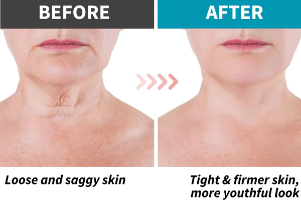 Sculptencé™ Skin Firming Lotion