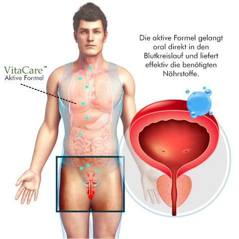 VitaCare™ Prostata-Behandlung Spray