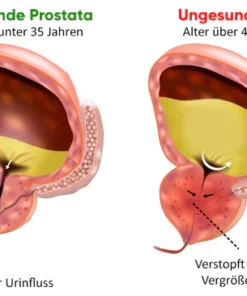 VitaCare™ Prostata-Behandlung Spray